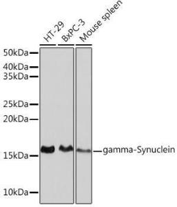 Western blot analysis of extracts of various cell lines, using Anti-gamma Synuclein / SNCG Antibody [ARC0762] (A309146) at 1:1,000 dilution. The secondary antibody was Goat Anti-Rabbit IgG H&L Antibody (HRP) at 1:10,000 dilution.