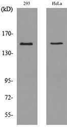 Antibody anti-PTPRJ 100 µg