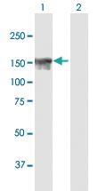 Anti-TONSL Mouse Polyclonal Antibody