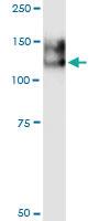 Anti-ANPEP Polyclonal Antibody Pair