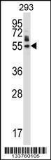 Anti-HEXIM1 Rabbit Polyclonal Antibody (HRP (Horseradish Peroxidase))