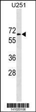 Anti-GGT1 Rabbit Polyclonal Antibody (AP (Alkaline Phosphatase))