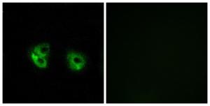 Immunofluorescence analysis of A549 cells using Anti-MARCH2 Antibody. The right hand panel represents a negative control, where the antibody was pre-incubated with the immunising peptide