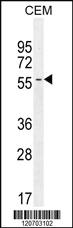 Anti-INHBA Rabbit Polyclonal Antibody