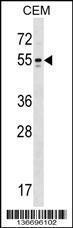 Anti-KCNA6 Rabbit Polyclonal Antibody (FITC (Fluorescein Isothiocyanate))