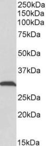 Anti-ATP5C1 Antibody (A83519) (0.1 µg/ml) staining of Rat Skeletal Muscle lysate (35 µg protein in RIPA buffer). Primary incubation was 1 hour. Detected by chemilu minescence