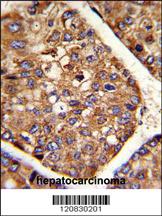 Anti-P4HB Rabbit Polyclonal Antibody