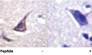 Anti-CASR Rabbit Polyclonal Antibody