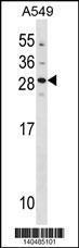 Anti-GUCA1B Rabbit Polyclonal Antibody (FITC (Fluorescein Isothiocyanate))