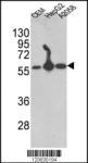 Anti-P4HB Rabbit Polyclonal Antibody