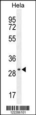 Anti-EMG1 Rabbit Polyclonal Antibody