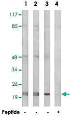 Anti-MRPL32 Rabbit Polyclonal Antibody