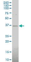 Anti-CHODL Mouse Polyclonal Antibody