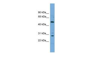 Anti-ULK3 Rabbit Polyclonal Antibody