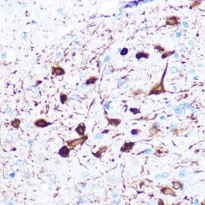 Immunohistochemistry analysis of paraffin-embedded rat brain using Anti-gamma Synuclein / SNCG Antibody [ARC0762] (A309146) at a dilution of 1:100 (40x lens). Perform microwave antigen retrieval with 10 mM PBS buffer pH 7.2 before commencing with IHC staining protocol.