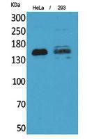 Antibody anti-PTPRJ 100 µg