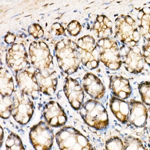 Immunohistochemistry analysis of paraffin-embedded rat colon using Anti-ERK1 + ERK2 Antibody [ARC0212] (A306245) at a dilution of 1:100 (40x lens). Perform high pressure antigen retrieval with 10 mM citrate buffer pH 6.0 before commencing with IHC staining protocol.