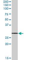 Anti-LYPLAL1 Goat Polyclonal Antibody