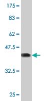 Anti-NFATC2IP Mouse Monoclonal Antibody [clone: 3E9-B7]