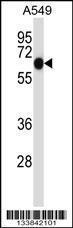 Anti-ALPPL2 Rabbit Polyclonal Antibody (Biotin)