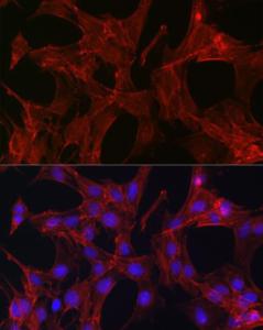 Anti-Gelsolin Rabbit Polyclonal Antibody