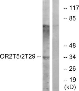 Anti-OR2T5 + OR2T29 Rabbit Polyclonal Antibody