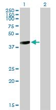 Anti-GALT Mouse Polyclonal Antibody