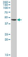 Anti-GALT Mouse Polyclonal Antibody