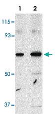 Anti-PAK4 Rabbit Polyclonal Antibody