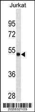 Anti-ARSA Mouse Monoclonal Antibody (FITC (Fluorescein Isothiocyanate)) [clone: 498CT24.1.2]