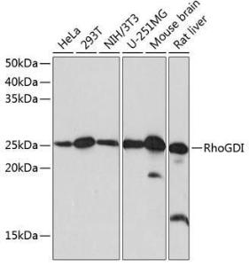 Western blot analysis of extracts of various cell lines, using Anti-RhoGDI Antibody [ARC0629] (A309147) at 1:1000 dilution. The secondary Antibody was Goat Anti-Rabbit IgG H&L Antibody (HRP) at 1:10000 dilution. Lysates/proteins were present at 25 µg per lane