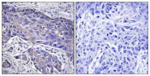 Anti-POFUT1 antibody