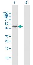 Anti-GALT Rabbit Polyclonal Antibody