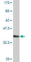 Anti-MYH3 Mouse Monoclonal Antibody [clone: 3H3]