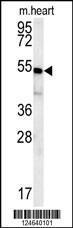 Anti-HEY2 Rabbit Polyclonal Antibody (APC (Allophycocyanin))