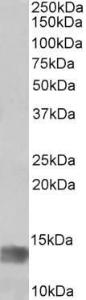 Anti-MIA Antibody (A83522) (1 µg/ml) staining of Human Glioma lysate (35 µg protein in RIPA buffer) Primary incubation was 1 hour Detected by chemiluminescence