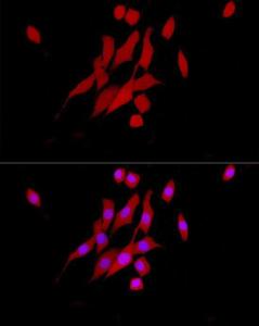 Immunofluorescence analysis of NIH/3T3 cells using Anti-ERK1 + ERK2 Antibody [ARC0212] (A306245) at a dilution of 1:50 (40x lens). DAPI was used to stain the cell nuclei (blue).