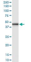 Anti-GALT Rabbit Polyclonal Antibody