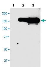 Anti-CFP Mouse Monoclonal Antibody [clone: 98s55]