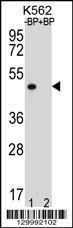 Anti-OR8K3 Rabbit Polyclonal Antibody (FITC (Fluorescein Isothiocyanate))