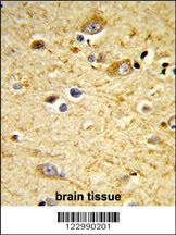 Anti-Glutathione S Transferase alpha 4 Rabbit Polyclonal Antibody (FITC (Fluorescein))