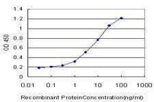 Anti-SGK1 Mouse Monoclonal Antibody [clone: 3E3]