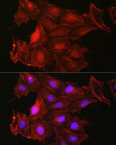 Anti-Gelsolin Rabbit Polyclonal Antibody