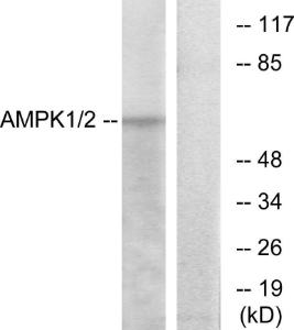 Anti-AMPK alpha 1 + AMPK alpha 2 Rabbit Polyclonal Antibody