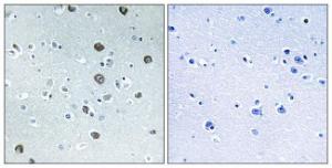 Immunohistochemical analysis of paraffin-embedded human brain tissue using Anti-MARCH2 Antibody. The right hand panel represents a negative control, where the antibody was pre-incubated with the immunising peptide