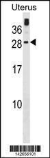 Anti-GUCA1C Rabbit Polyclonal Antibody (APC (Allophycocyanin))