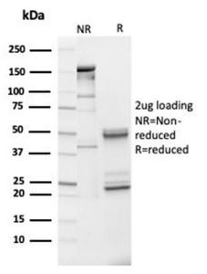 SDS-PAGE analysis of Anti-IGFBP3 Antibody [IGFBP3/3517] under non-reduced and reduced conditions; showing intact IgG and intact heavy and light chains, respectively. SDS-PAGE analysis confirms the integrity and purity of the antibody