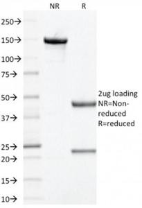 SDS-PAGE analysis of Anti-Prohibitin Antibody [PHB/1881] under non-reduced and reduced conditions; showing intact IgG and intact heavy and light chains, respectively. SDS-PAGE analysis confirms the integrity and purity of the Antibody