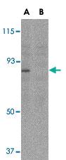 Anti-AICDA Rabbit Polyclonal Antibody