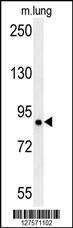 Anti-LRRC4B Rabbit Polyclonal Antibody (PE (Phycoerythrin))